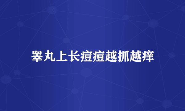 睾丸上长痘痘越抓越痒