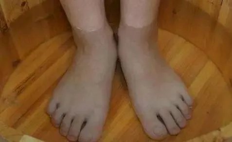 身体出现哪些症状,就说明你该排毒了呢?