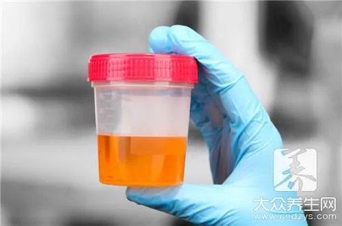 尿糖的正常值