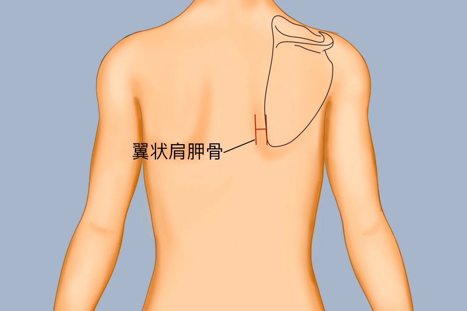 肩胛骨突出图片