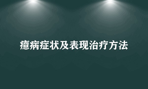癔病症状及表现治疗方法