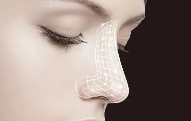 鼻部手术术价格