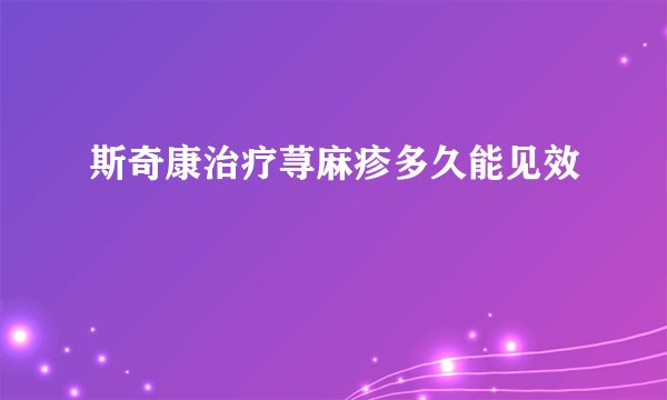 斯奇康治疗荨麻疹多久能见效