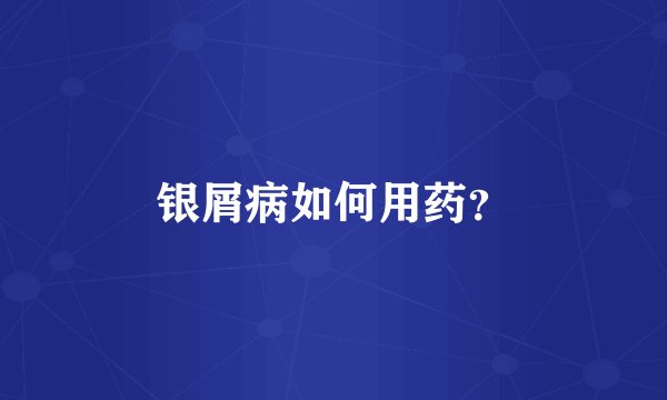 银屑病如何用药？