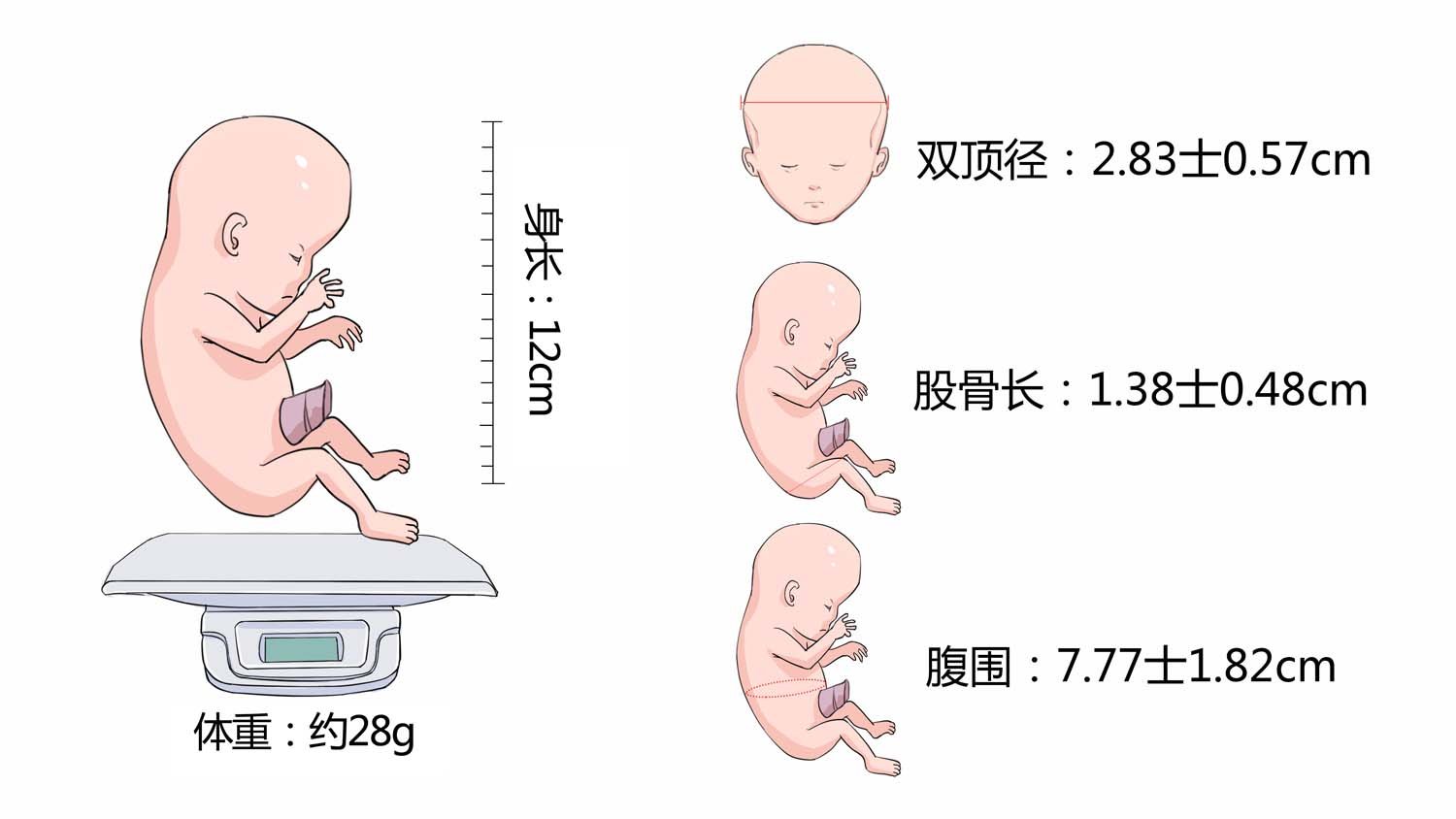 怀孕第14周
