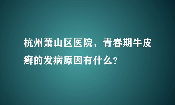 杭州萧山区医院,青春期牛皮癣的发病原因有什么?
