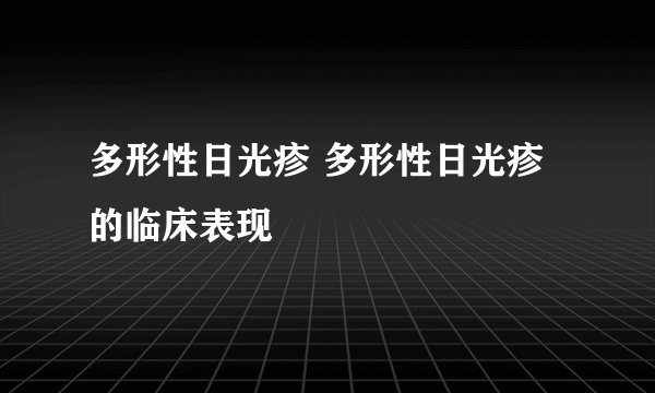多形性日光疹 多形性日光疹的临床表现