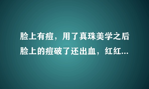 脸上有痘，用了真珠美学之后脸上的痘破了还出血，红红的，怎么回事？真珠美学有激素吗？