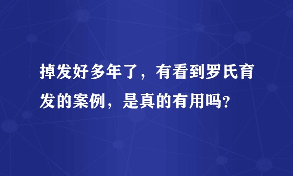 掉发好多年了，有看到罗氏育发的案例，是真的有用吗？