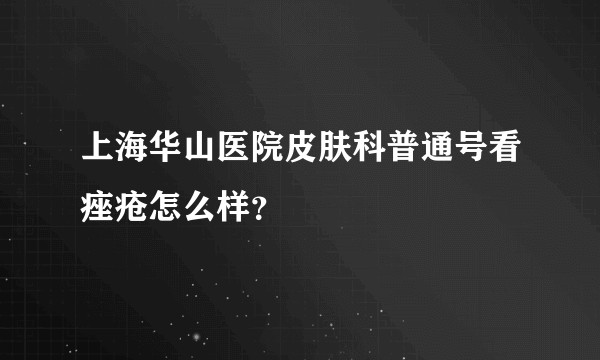 上海华山医院皮肤科普通号看痤疮怎么样？